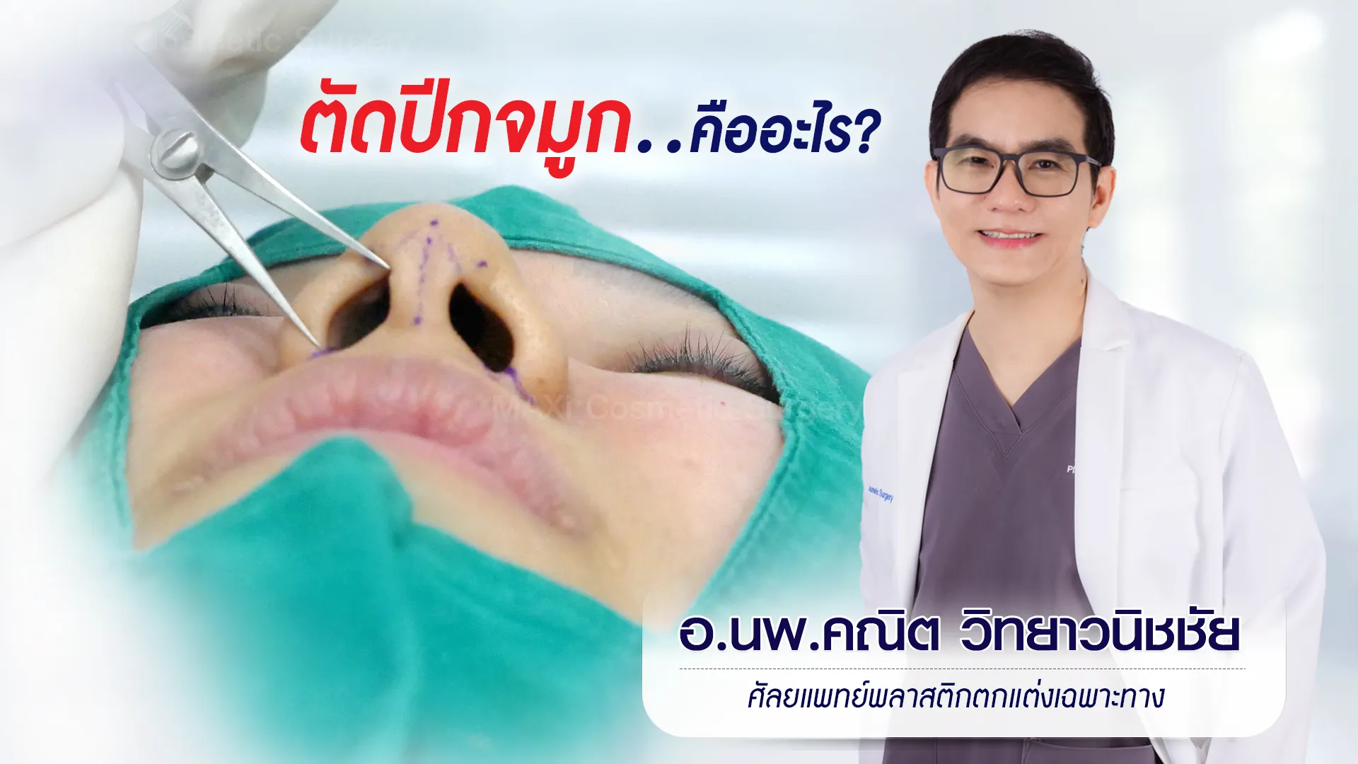 แนะนำการตัดปีกจมูก พร้อมตอบคำถามตัดปีกจมูกที่ไหนดี รีวิวก่อน–หลังทำจริง พร้อมข้อควรรู้สำหรับมือใหม่ที่สนใจศัลยกรรมจมูกให้ดูเรียวเล็กลงกับหมอคณิต