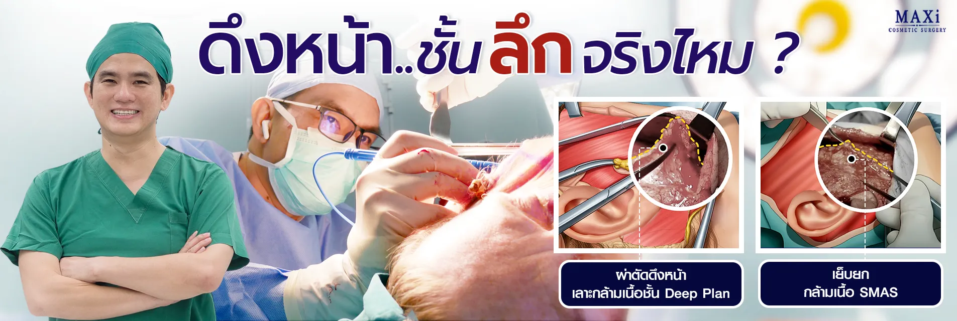 ภาพดึงหน้าชั้นลึกโดยหมอคณิต เทคนิค Deep Plane เห็นผลชัด ใบหน้ากระชับดูอ่อนวัย