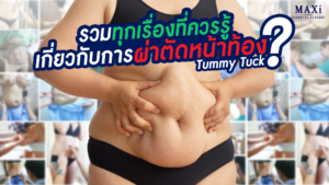 ผลลัพธ์หลังผ่าตัดไขมันหน้าท้องและยกกระชับหน้าท้อง ช่วยลดไขมันส่วนเกิน หน้าท้องแบนเรียบ ดูกระชับขึ้นอย่างเป็นธรรมชาติ