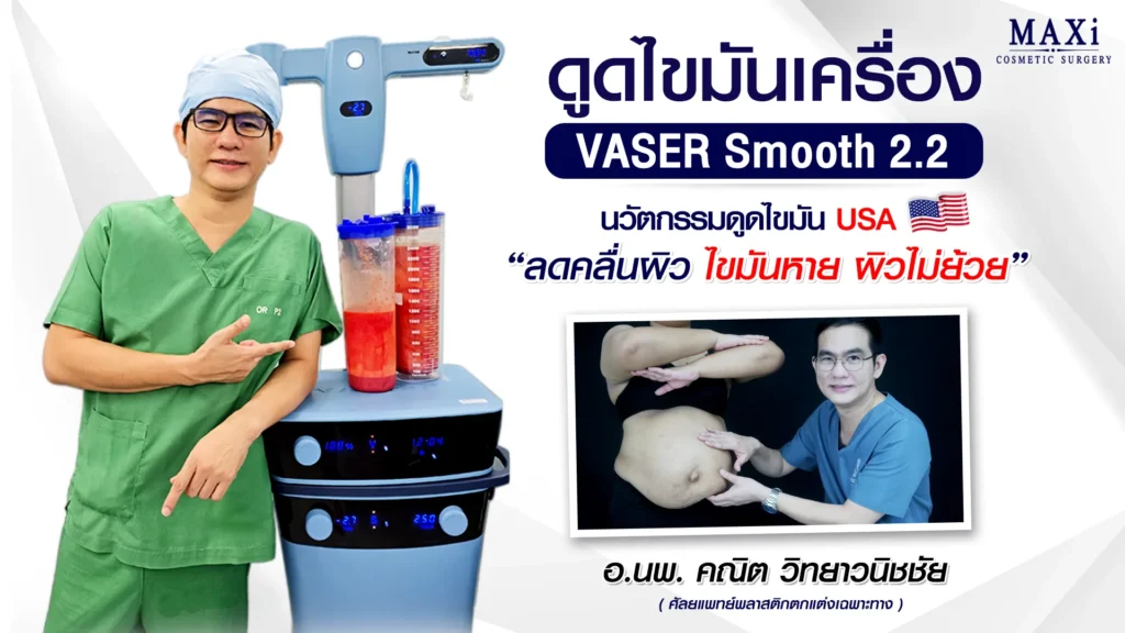 ดูดไขมันหน้าท้อง เครื่อง VASER Smooth 2.2 กับคุณหมอคณิต